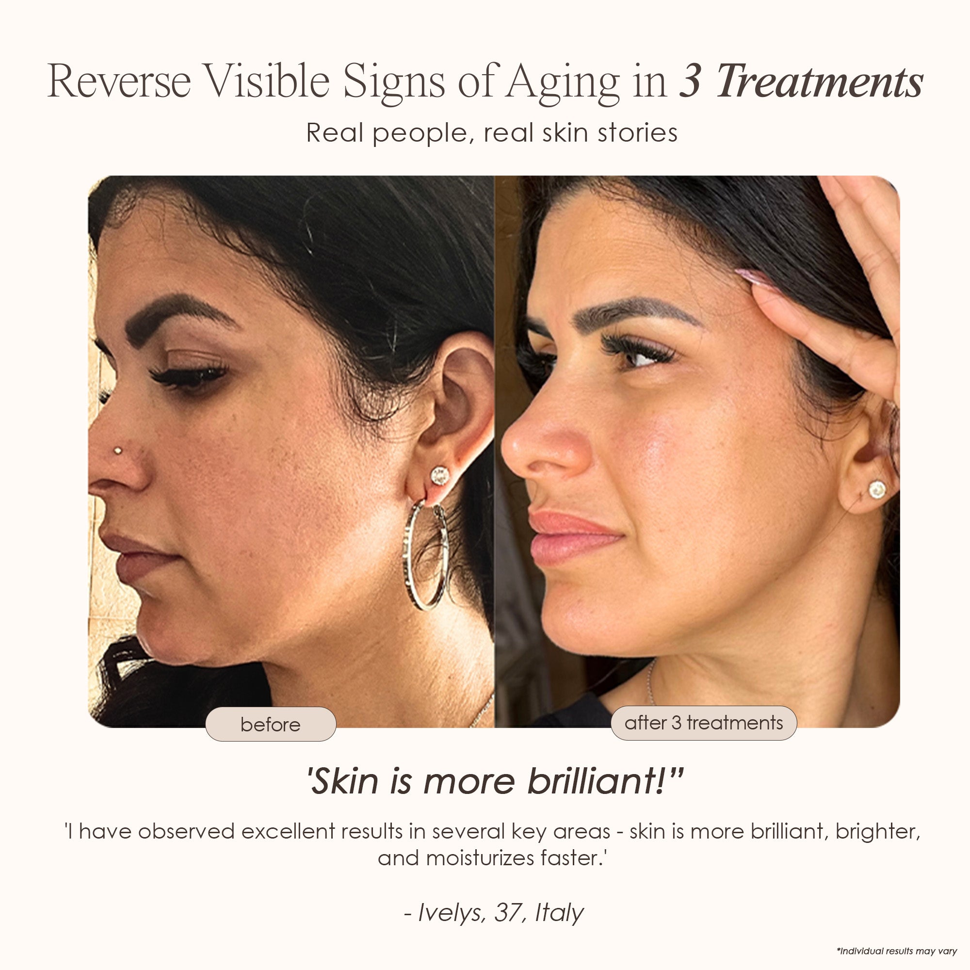 REVA instant age renewal wand before and after where skin is brighter after 30 days